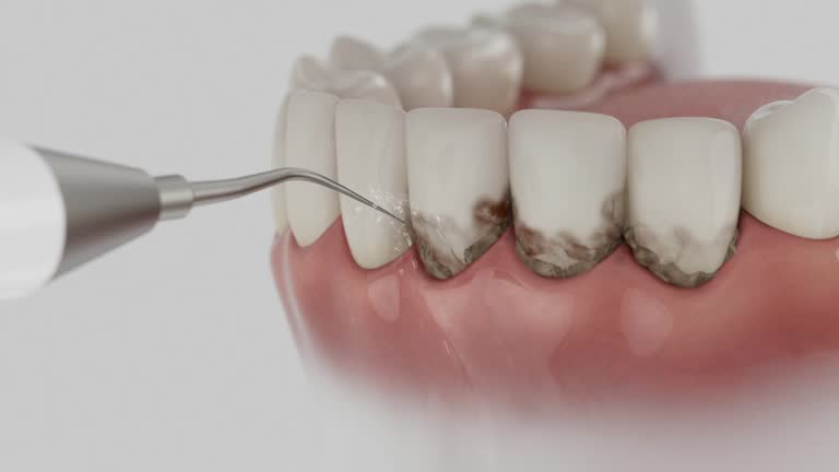 Reliable Wisdom Tooth Removal contractor in Platte County County, WY by Dentist Open Now